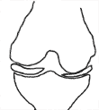 diagram of knee and PARTIALLY obliterated joint space